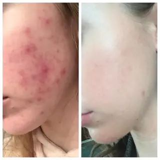 siro スタッフのエステ・リラクイメージ