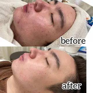 laluna saki...のその他イメージ