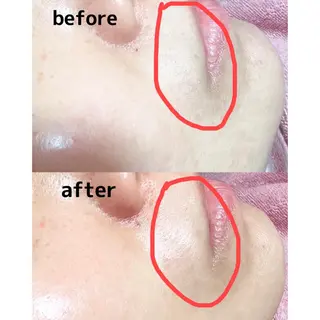pearl crown所属・pearlcrown 博多Wax＆光脱毛のその他イメージ