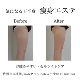 ユニセックスエステサロンUniclear所属・男女エステ ユニクリアのエステ・リラクイメージ