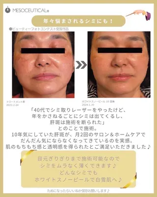RinRin 豊田店のエステ・リラクイメージ