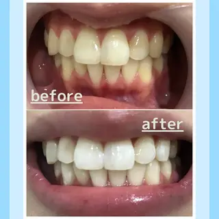 メンズ お手軽ホワイトニングsalon mina所属・武元 奈津美のその他イメージ