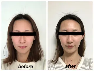 Radiance H.Oのエステ・リラクイメージ