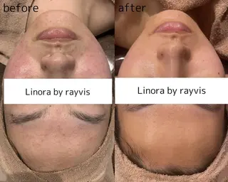 👑Linolaby RAYVIS👑⭐️のエステ・リラクイメージ