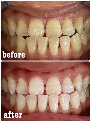 ホワイトニングサロン ラウレアのその他イメージ