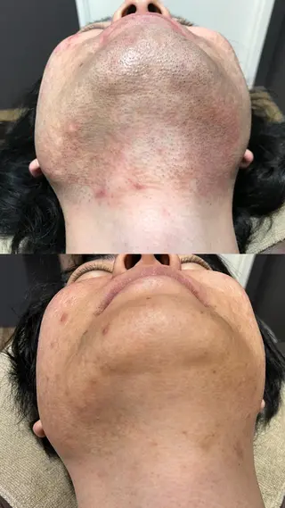 Lilyboo 池袋のエステ・リラクイメージ