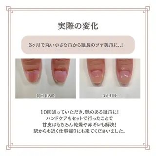 ネイル 自爪育成専門サロン エムロードゥ池下のネイルデザイン