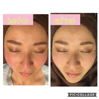 癒し腸もみサロン シャユーム　ゆきなのエステ・リラクイメージ