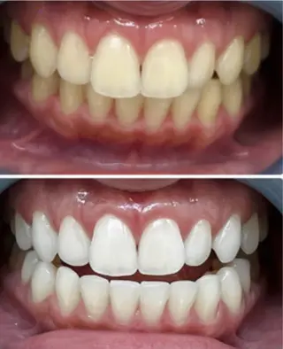 セルフホワイトニングサロンMW 新越谷店所属・セルフホワイトニング サロンMW新越谷店のその他イメージ