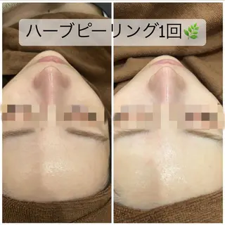 セミロング カラー パーマ ヘアアレンジ メンズ キッズ ネイル マツエク・マツパ アイブロウ Amaryllis 🌹松本のエステ・リラクイメージ