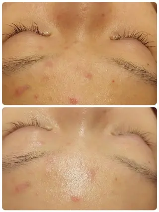 MyFairLady miuのエステ・リラクイメージ