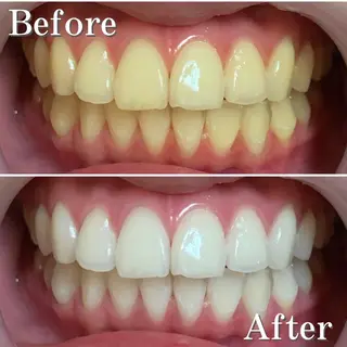 マツエク・マツパ ショート ヘアアレンジ パーマ カラー メンズ ネイル アイブロウ LBSホワイトニング 銀座店💎公式のその他イメージ