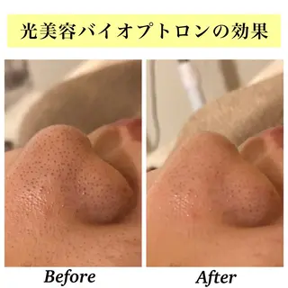 Bellesthe (ベルエステ)のエステ・リラクイメージ