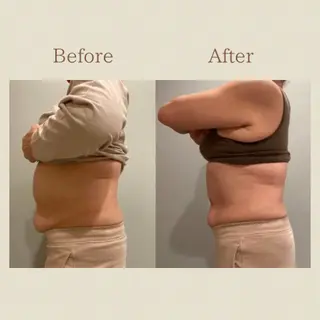 お腹痩せエステ Flat BELLY 恵比寿所属・【腸もみ/冷却痩身】 お腹エステ/恵比寿のエステ・リラクイメージ