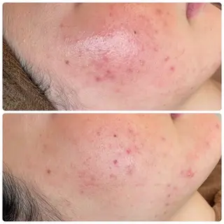 肌質改善エステ chiffonのエステ・リラクイメージ