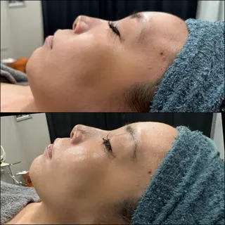 LiZA エステティックサロンのエステ・リラクイメージ