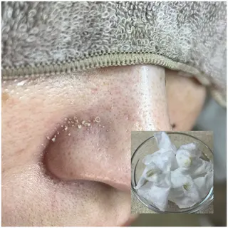 毛穴洗浄専門店/ 泉佐野/oluoluのエステ・リラクイメージ