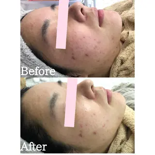 BestBelleꕤ 大阪福島/肌質改善のエステ・リラクイメージ