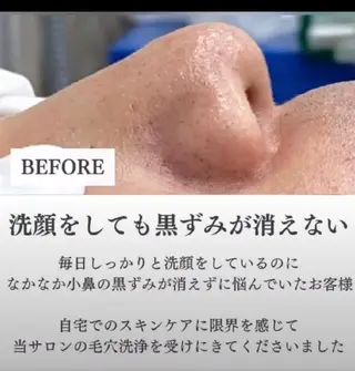 エイジングケアサロンBIOEL所属・肌質改善BIOELプ ラズマ/ラミピールのエステ・リラクイメージ