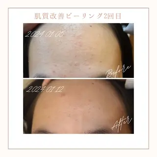 小顔×肌質改善サロン soin〔ソワン〕のエステ・リラクイメージ