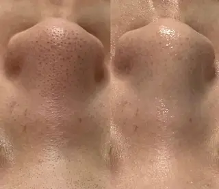 BestBelleꕤ 大阪福島/肌質改善のエステ・リラクイメージ