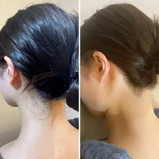 うなじ脱毛/美肌脱毛 LABELのエステ・リラクイメージ