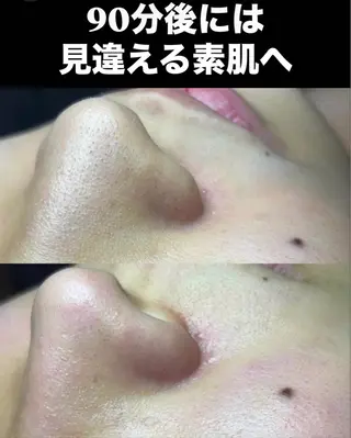 セルフエステエンリケ明石大久保店所属・YUUKI リンパ＆脱毛&毛穴のエステ・リラクイメージ