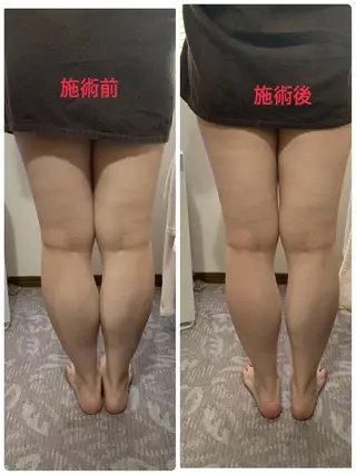 espoir エスポワールのネイルデザイン