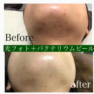 美肌脱毛と癒しのﾌﾟﾗｲﾍﾞｰﾄｻﾛﾝ。gratia~ｸﾞﾚｲﾃｨｱ~所属・gratia ~ｸﾞﾚｲﾃｨｱ~のエステ・リラクイメージ