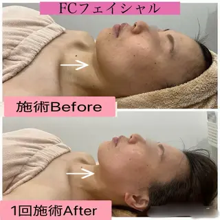 ブライダル痩身×脱毛 尼崎駅前サロンのエステ・リラクイメージ