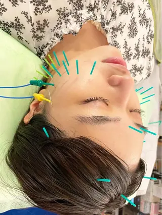 小顔美容鍼専門サロン 渋谷YZのエステ・リラクイメージ