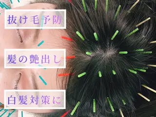 小顔美容鍼専門サロン 渋谷YZのエステ・リラクイメージ