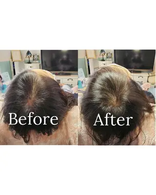 歯科提携セルフダック 宇都宮駒生店のエステ・リラクイメージ