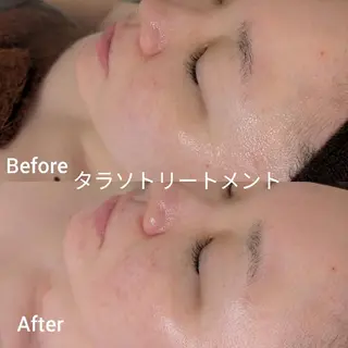 フェイシャルエステ ラトゥール伊深のエステ・リラクイメージ