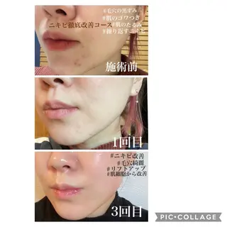 De I'm トータルビューティーサロン所属・COCO beautyサロンのエステ・リラクイメージ