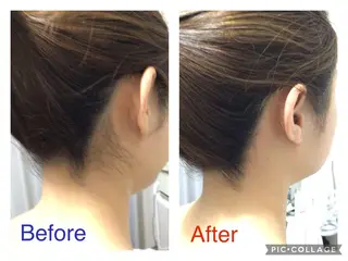 子宮矯正/腸揉み/ シュガーリング脱毛のエステ・リラクイメージ