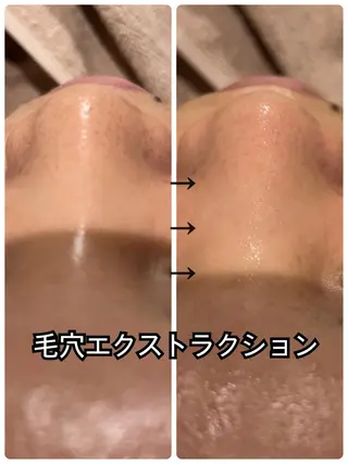 Dione八王子店所属・LUKE （ルーク）のエステ・リラクイメージ