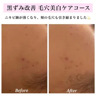 Bellesthe (ベルエステ)のエステ・リラクイメージ