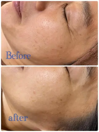 サロンドプララン所属・サロンド プラランのエステ・リラクイメージ