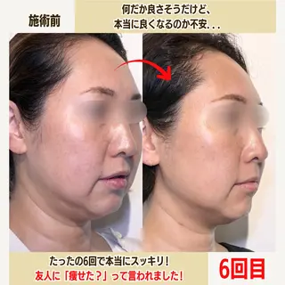 経堂鍼灸整体院 古木のエステ・リラクイメージ