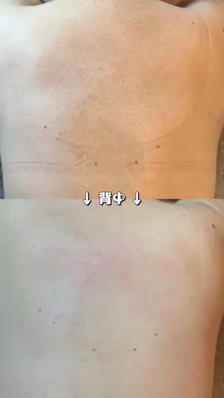 Hit. シュガーリング豊橋のエステ・リラクイメージ