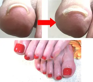 ネイル イワサキ  のネイルデザイン