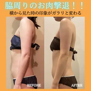 痩身&美肌サロン ビュースタ 伊藤🌷のその他イメージ