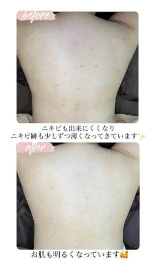 ベラージュ【美背中・ 美尻・フェイシャル】のエステ・リラクイメージ