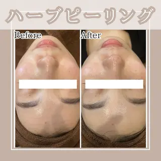 メンズ キッズ Amaryllis 🌹松本のエステ・リラクイメージ