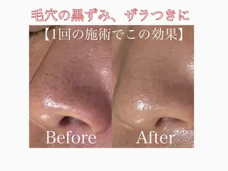 🌸🧡六本木 脱毛しずか🧡🫧の眉毛・アイブロウイメージ