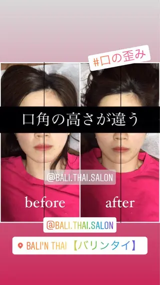 🌈歪み改善🌈 バリンタイ すぎうらのエステ・リラクイメージ