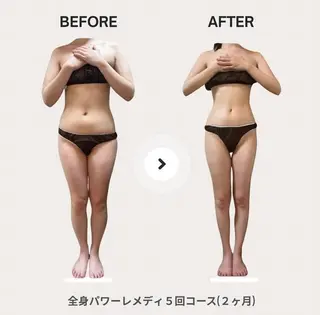 biloop所属・《痩身×疲労改善》 BILOOPのエステ・リラクイメージ