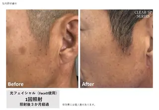 VIERU YURIのネイルデザイン