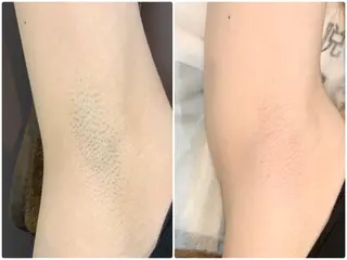 【天神・大名】脱毛/ ハーブ植松७९०のその他イメージ